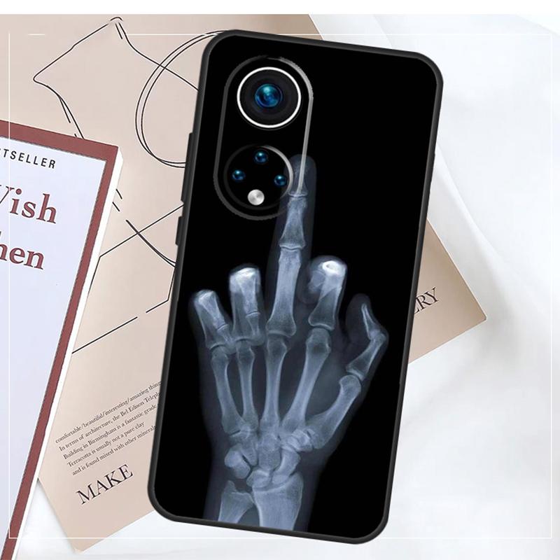 Skeleton Middle Finger For Honor 90 Lite 50 70 Magic 6 5 Pro Case For Honor X9b X8b X7a X6a X9 X7 X8 X8a X9a Cover
