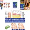 Ximonth Foot Care Pack With Nourishing Ingredients For Softened Skin And Callus Repair