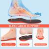 Linkidea Arch Support Shoe 2 Replacement Shoe Inserts with Shock Absorption Cushioning for Allbirds Tree Runner and Wool Runner AB00FU Insoles, Pairs,