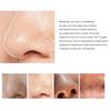10Pcs Blackhead Acne Remover Nose Cover Sticker Pore Cleaning Strip Skin Care