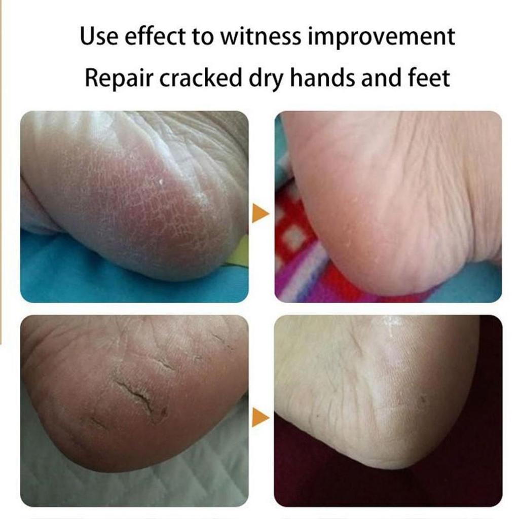 Ma You Hand and Foot Repair Cream doplňuje vlhkost, opravuje poškozenou pokožku nohou, obnovuje zdravou pokožku nohou a hydratuje a chrání nohy.