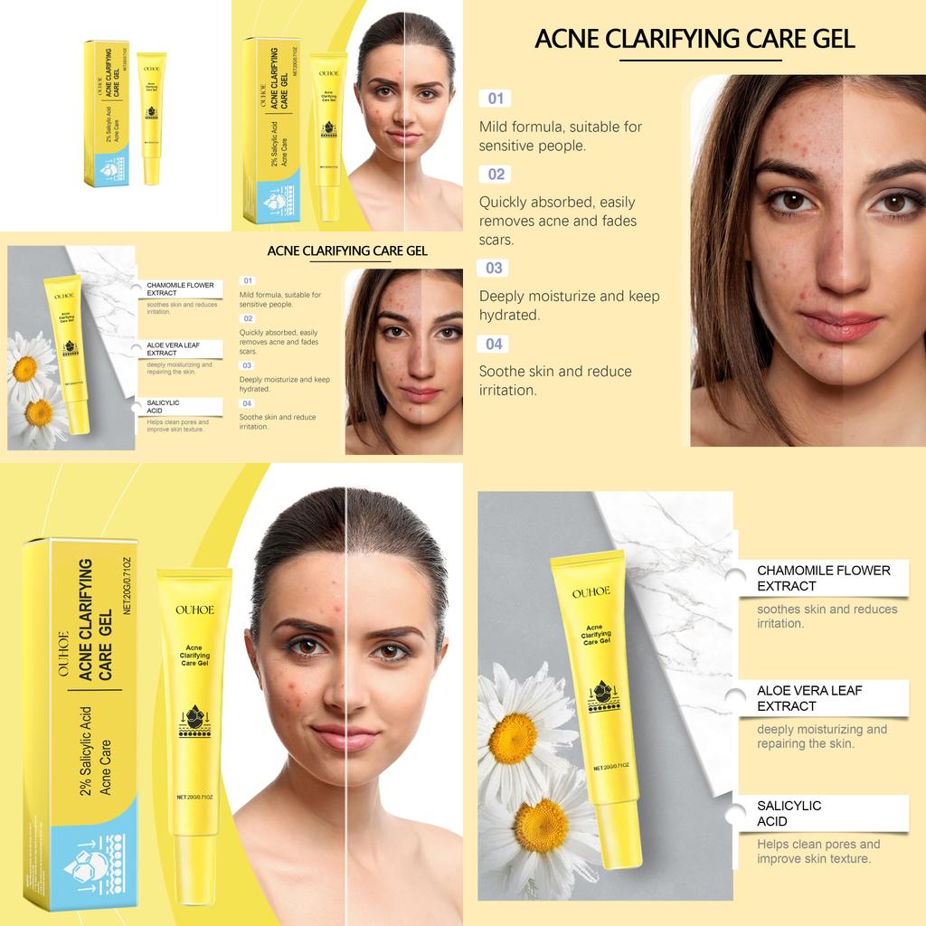 Ouhoe Acne Gel For Deep Cleansing And Brightening Skin With Pore Minimizing Formula 20g