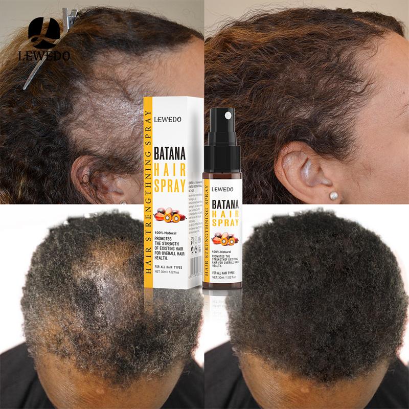 Spray Batana Hidratare Profundă Creștere Păr Reparare Păr Deteriorat Super Neted Creștere Africană Anti Cădere Păr