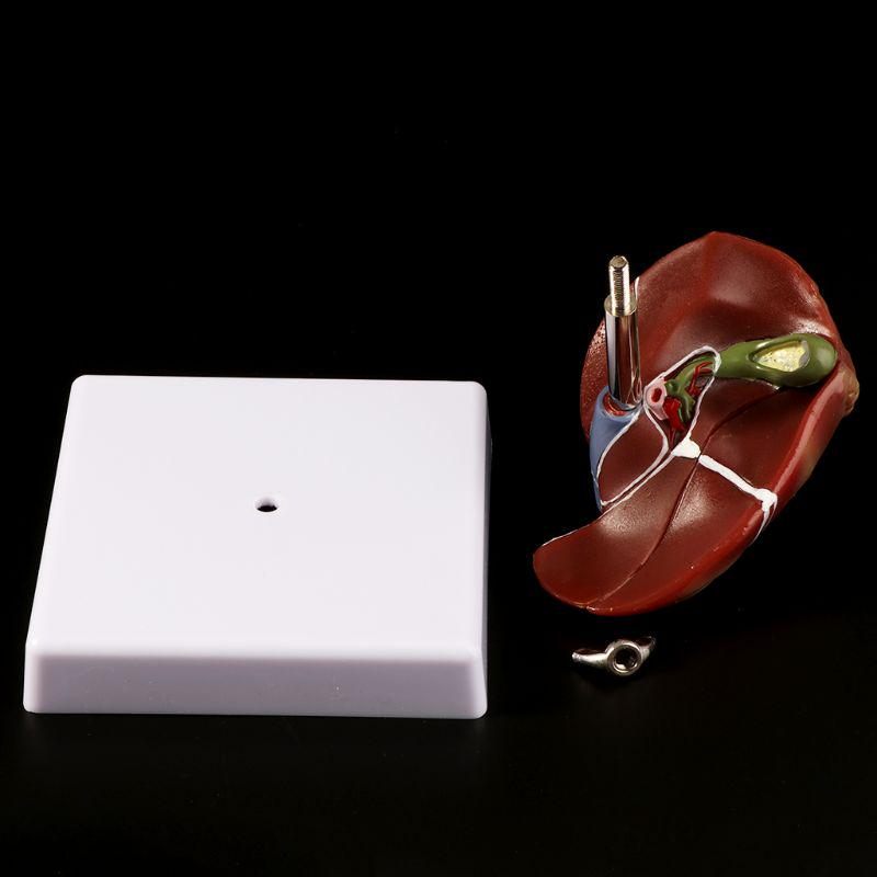 Pathologisches anatomisches Modell der menschlichen Leber, Anatomieschule, medizinisches Lehrdisplay, Laborausrüstung