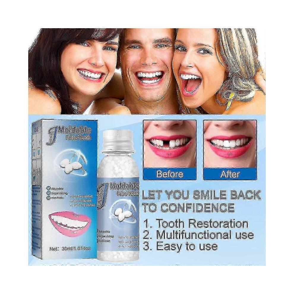20ml Permanent Dental Cement For Strong Tooth Repair - Cavity Filling Kit For Dentures