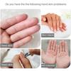 Exfoliating Moisture  Hand Mask Peeling Remove Hard Dead Skin Mask 1Pcs 5ml