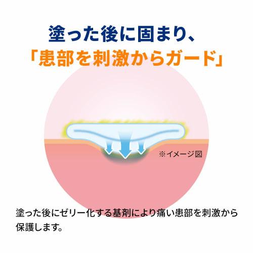 [Designated Category 2 OTC drug] Aphthaguard 5g