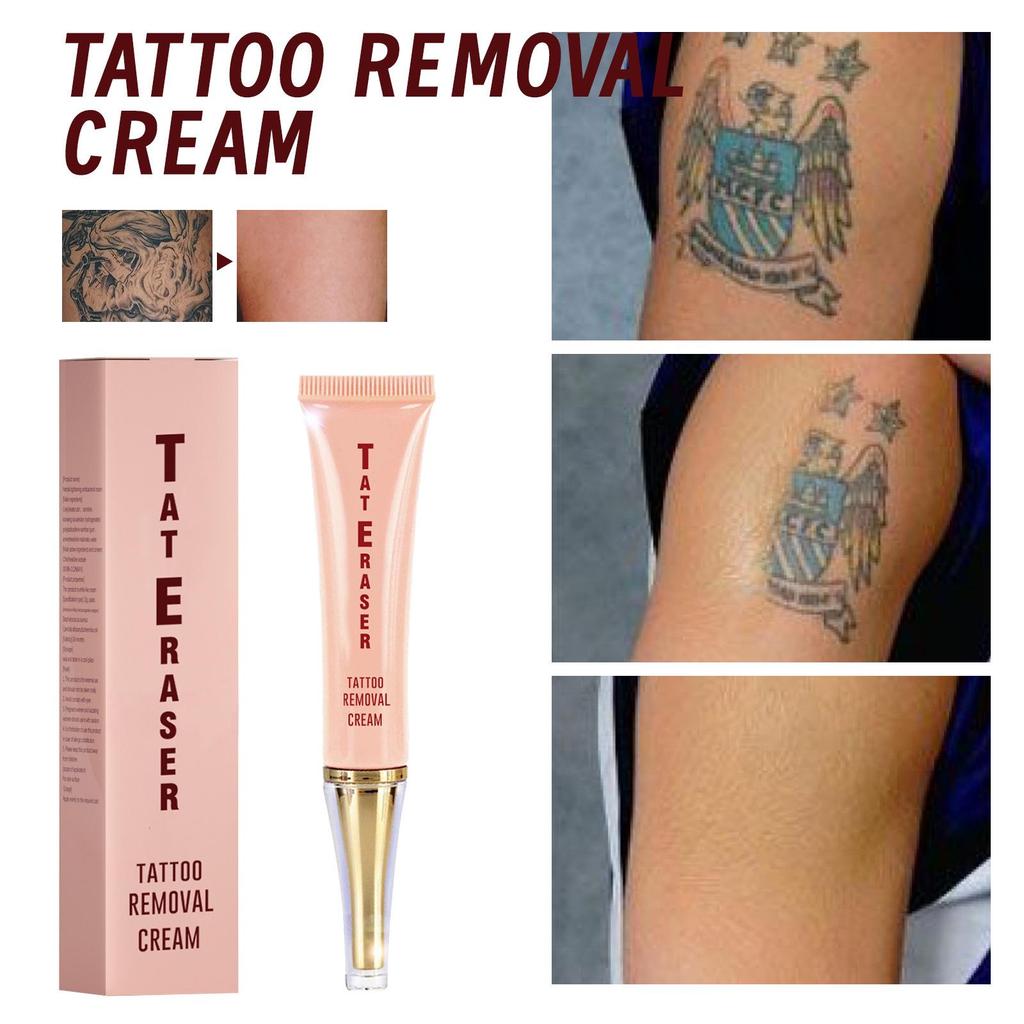 Quick-Fade Tattoo Removal and Cleansing Cream