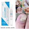 3ml Nail Problem Treatment of Onychomycosis Repair 1 Bottle Bacteriostat  5 Bottles for 30 Days