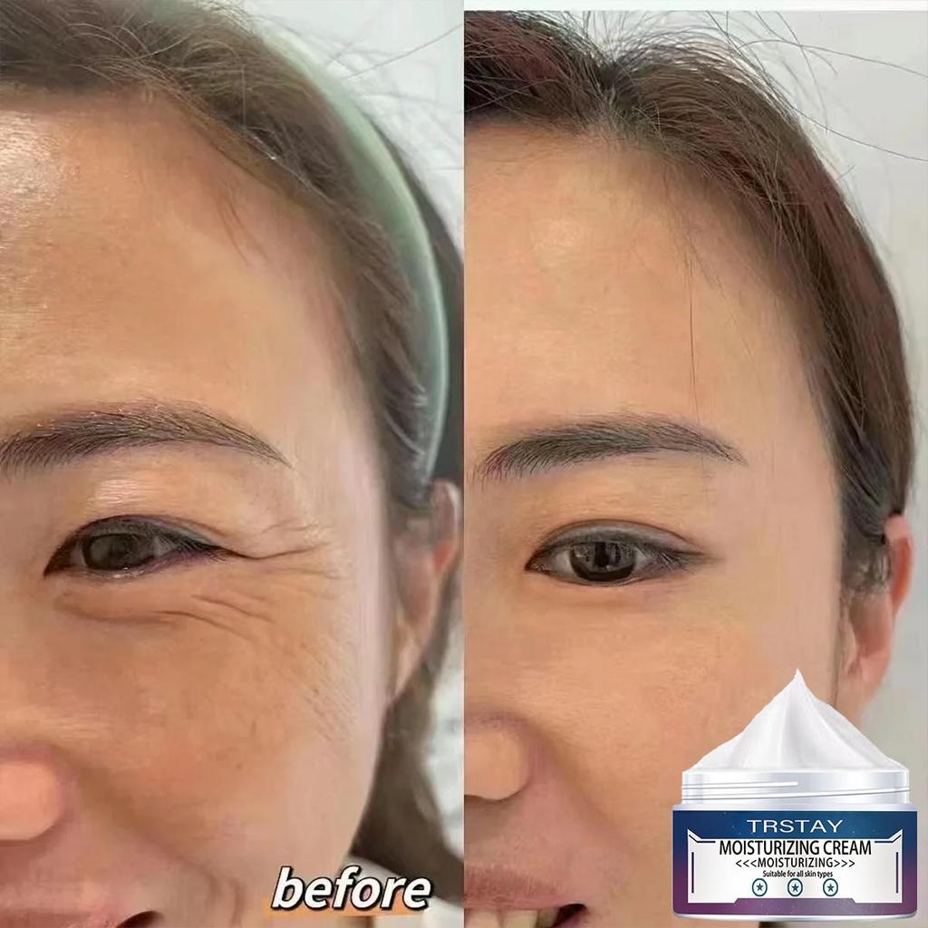 La crema para ojos es suave y no irritante, suaviza las arrugas, reduce las líneas finas, mejora la piel dañada e hidrata la piel.
