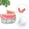 Modello Denti Dentali Trasparente 4 Impianti Overdenture Ponte Rimovibile Modello Mandibolare Inferiore M6003 Materiali per Studio Dentistico