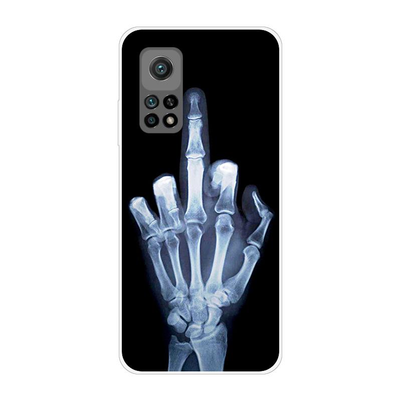 For Xiaomi Mi 10T 5G Case Shockproof Soft Silicone TPU Back Cover For Xiaomi Mi 10T Pro Phone Cases for Xiaomi Mi 10 T 10T Coque