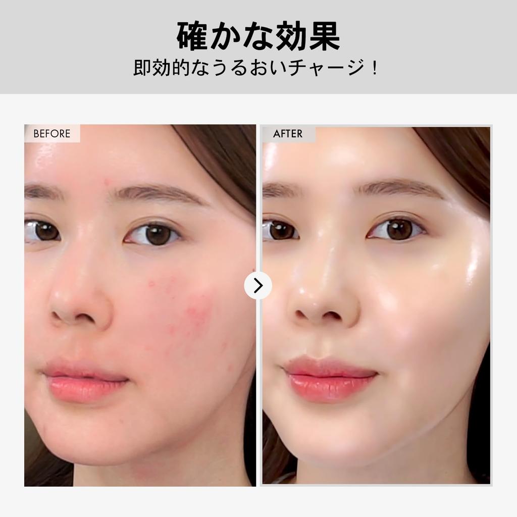 TOSOWOONG Hyaluronic Acid Hyaluronic Acid and Improves Skin Large For Dry Korean Skincare Cosmetics Ampoule, 100ml, Panthenol, Hydrating,