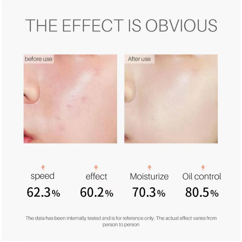 Retinolové sérum proti vyblednutí vrásek Tmavé skvrny Vitamin C Sérum na obličej Whiten Face Skincare Essence Produkty péče o pleť