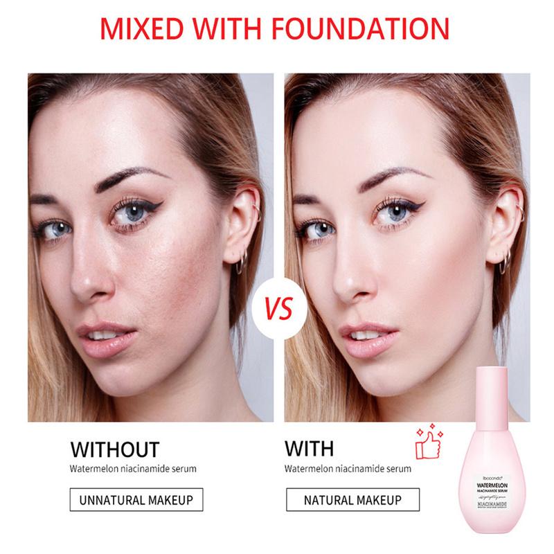 Nicotinamide Essence Watermelon Light Bulb Brightening Essence Hydrating Treasure Moist Face Essence