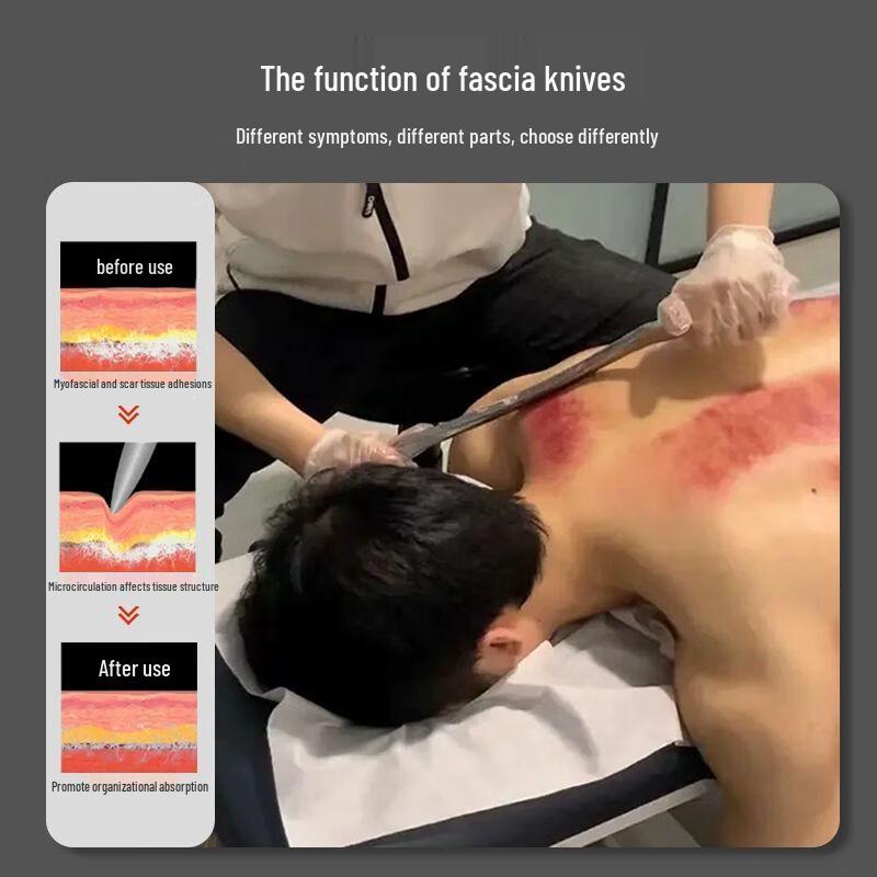 Professionell Fasciafrisläppningsverktygssats