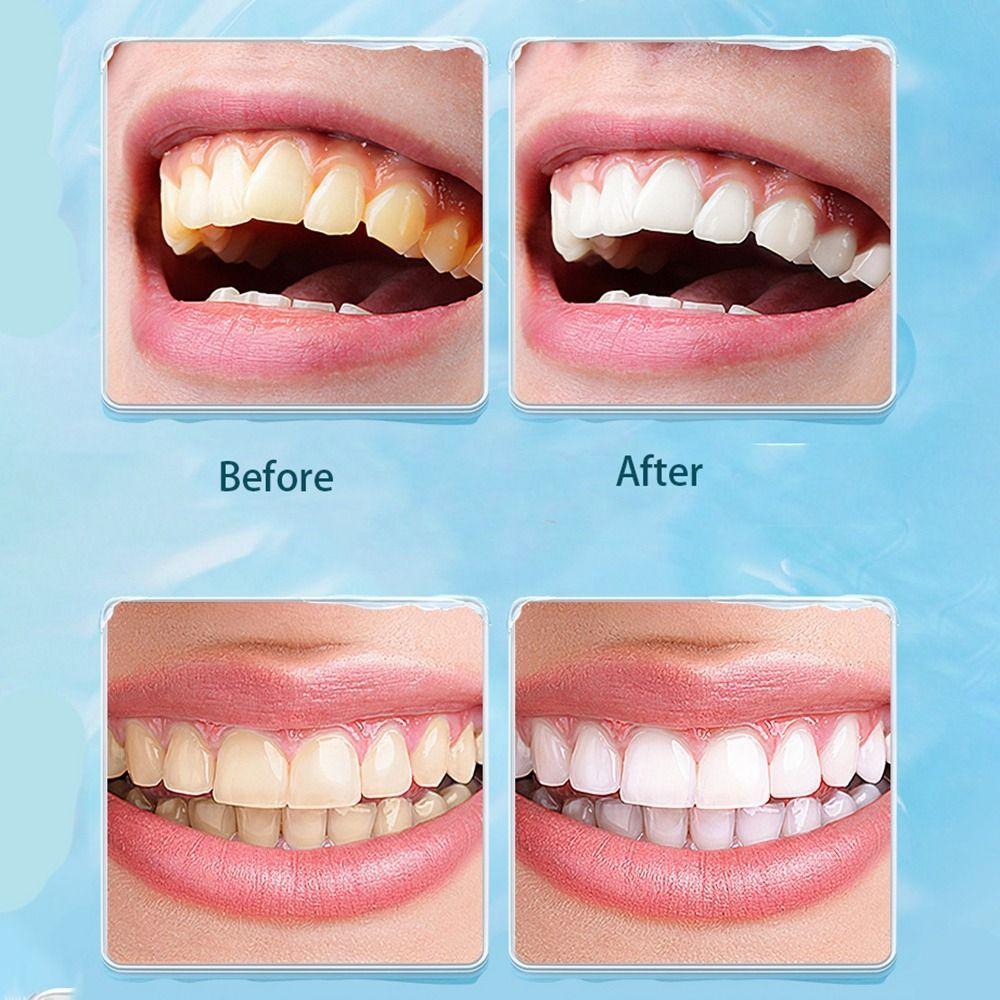 Dental Scaler Dental Stain Cleaning Brush Removing Tartar Dental Cleaning Tool Men