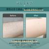 Painless Hair Removal Salon IPL Light Hair Removal Machine Datsumouki Home Epilator Tusuny Epilator Compatible with VIO Full Body Unwanted Hair Care
