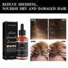 3x Hair Growth Products Ginger Extract Growing Hair Essential Oil Beauty Hair Care Prevent Hair Loss Oil Scalp Treatment For Men Women