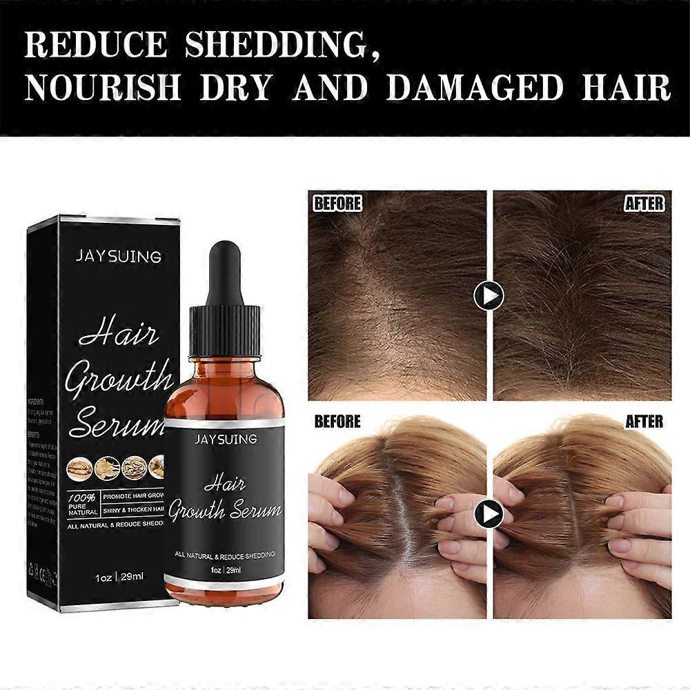 3x Hair Growth Products Ginger Extract Growing Hair Essential Oil Beauty Hair Care Prevent Hair Loss Oil Scalp Treatment For Men Women