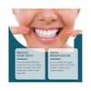 ORALHOE silicone denture repair kit, daily improvement of the beauty of the smile, comfortable material modification of teeth