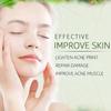 Crème anti-acné pour le visage, élimine les pores dilatés, traite l'acné, contrôle du sébum, réduit les pores, crème pour le visage, soins de la peau, beauté et santé