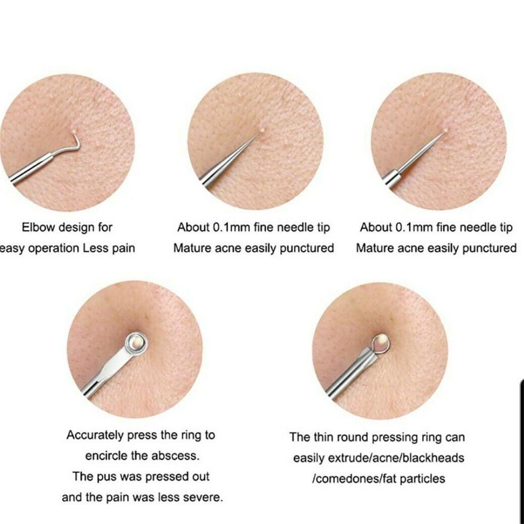 4 Piece Stainless Blackhead Remover Tool Set - Extractor Needle for Facial , Comedone Pusher, Home Kit