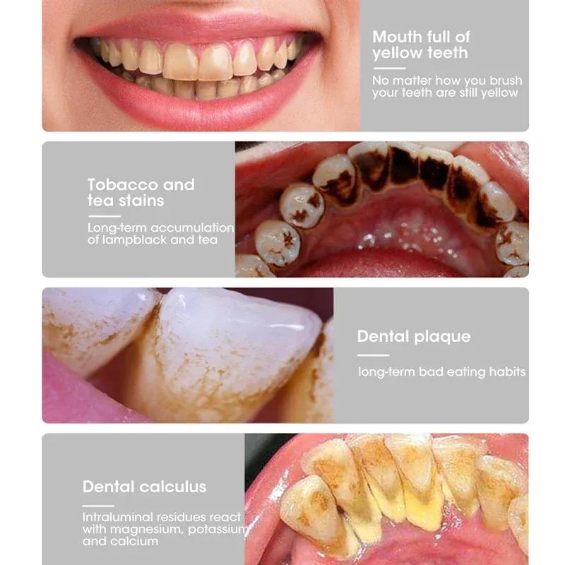 Spazzolino elettrico Sonic Dental Kit sbiancante per denti Sbiancante per denti Calcolo Tartaro Rimozione Strumenti Detergente Macchie Cura orale