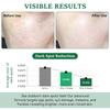 Dark Spot Remover for Face and Body - Dark Spot Corrector for Sun Spots Age Spots Freckles Melasma Brown Spot - Dark Spot Correcting Glow Serum with