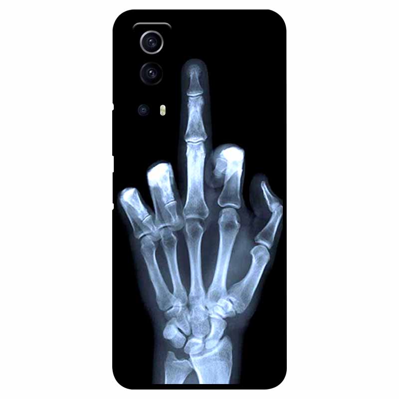 For vivo Y72 5G Case Shockproof Soft silicone TPU Back Cover For vivo Y52 5G Phone Cases for vivoY72 Y 72 52 5G Case Cute Capa