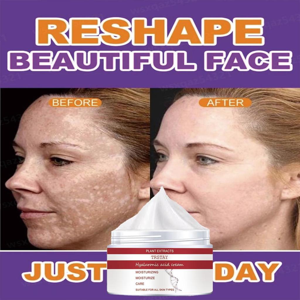 Brightening Anti-aging Cream, Slows Down Collagen Loss, Rejuvenates Skin, Reduces Wrinkles, and Anti-aging