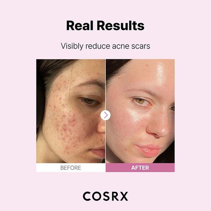 COSRX The Niacinamide 15 Serum