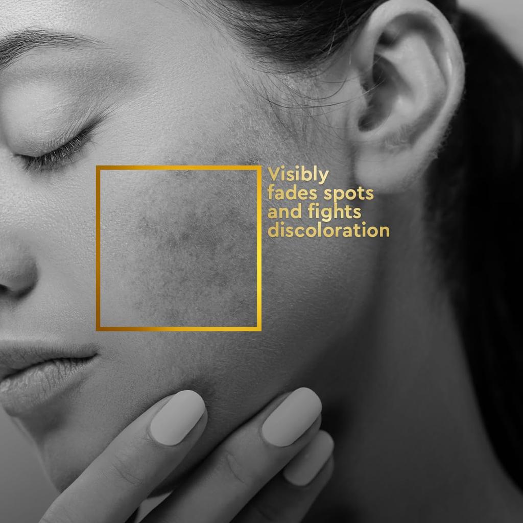 VLCC Clinic ProPerfect Spot Clarifying Face Wash 150 Ml Pack | Fade Dark Spots & Even Skin Tone