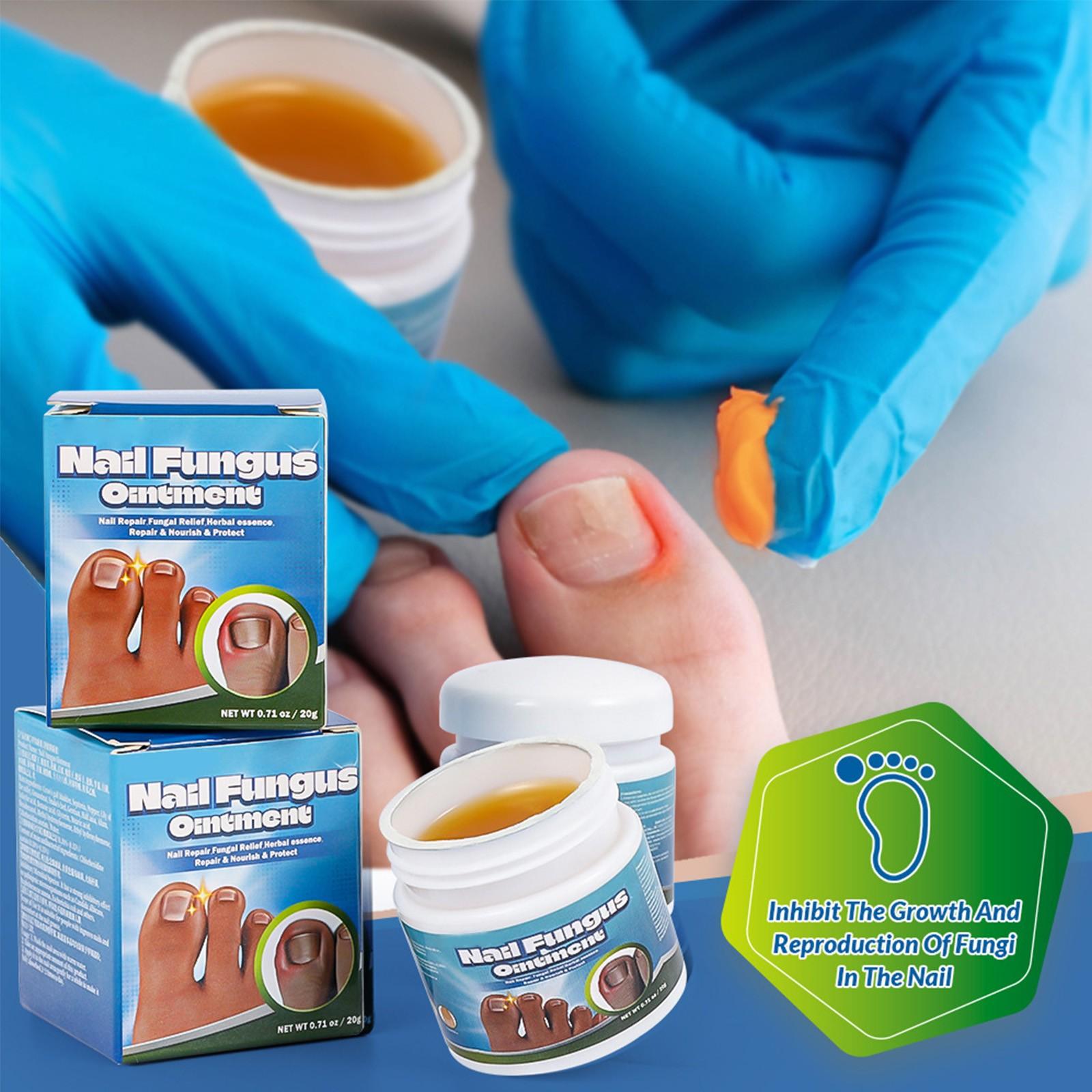 

Крем для восстановления при паронихии Крем для ухода за ногтями и ногтями на ногах Nail And Nail Grey-Nail Repair-Cream One Size синий