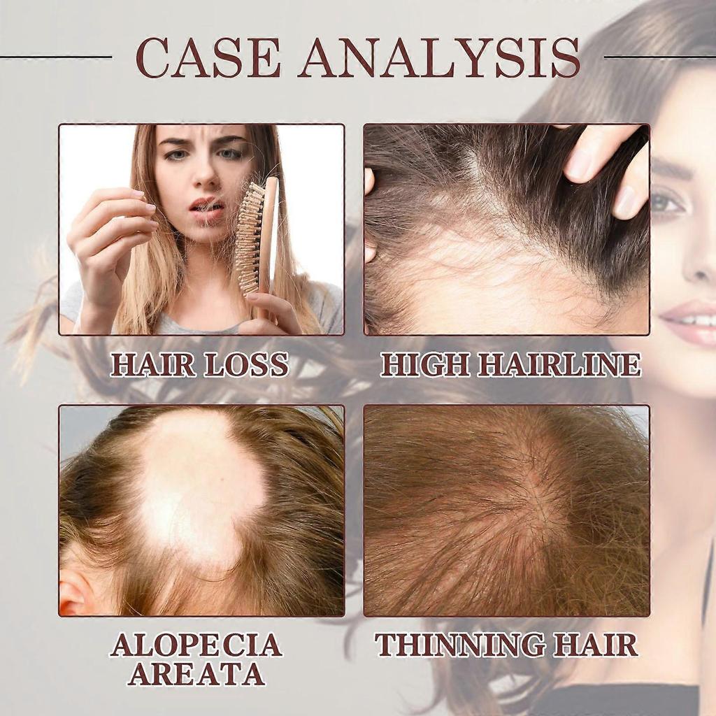 2025 Latest Model Coconut Hair Care Essential Oil Moisturizes and Strengthens