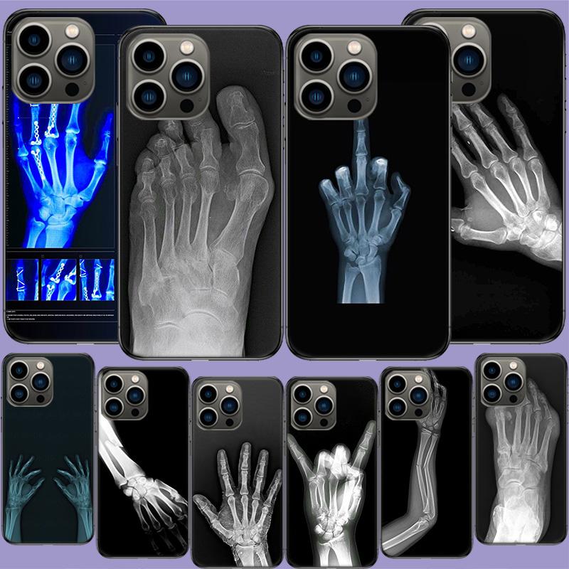 Herbst Röntgen Handknochen Handyhülle Für Apple Iphone 16E 16 17 Pro Max Air 15 Pro 14 Plus 12 13 Mini Hülle Niedliche Fundas Silico