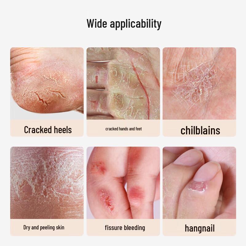 Yongan Hubiao Saffron Chapped Skin Repair Cream