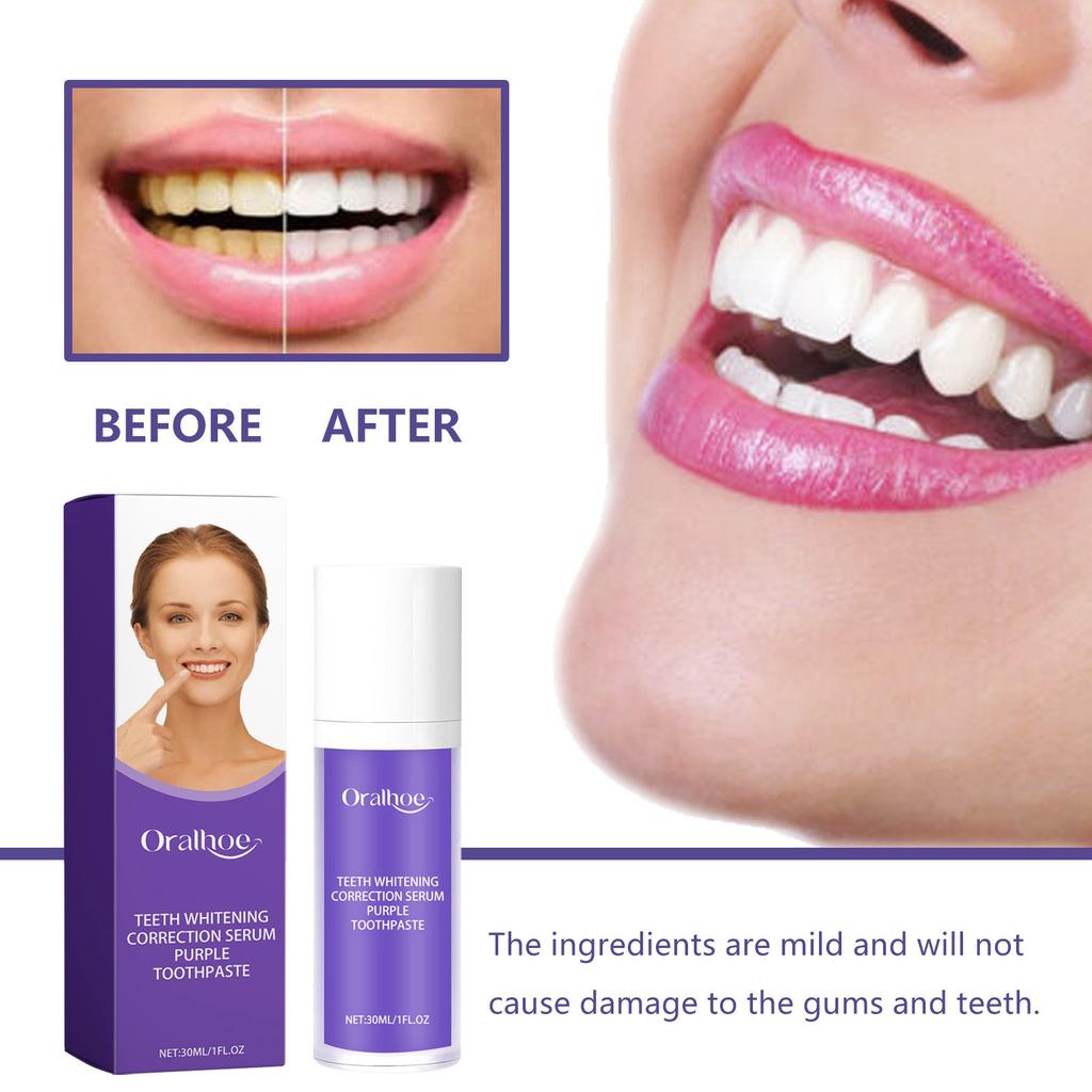Toothpaste For Deep Cleaning Teeth Care Brightening Warming And Protecting Gums Refreshing Breath And Removing Odors 30ml