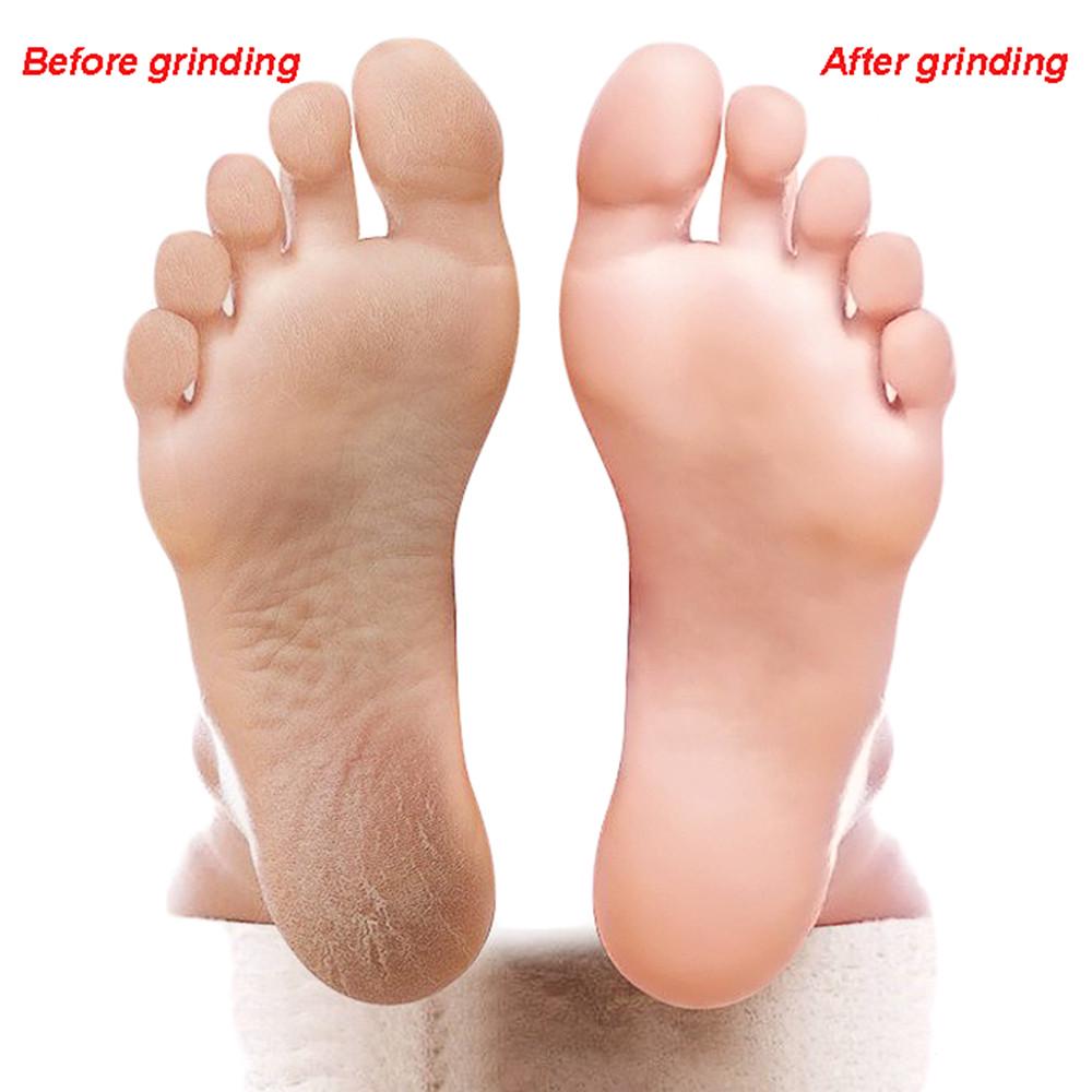 Double Sided Exfoliating Heel Grater Dead Skin Remove Pedicure Tool Foot File Foot Rasp Skin Care