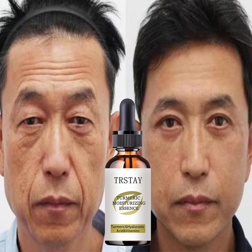 5G/15G/30G/50G/ TRSTAY Neck and Face Nourishing and Moisturizing Papaya - Rose Oil - Raw Honey Trees Fruit Oil Calendula Oil Joba Oil