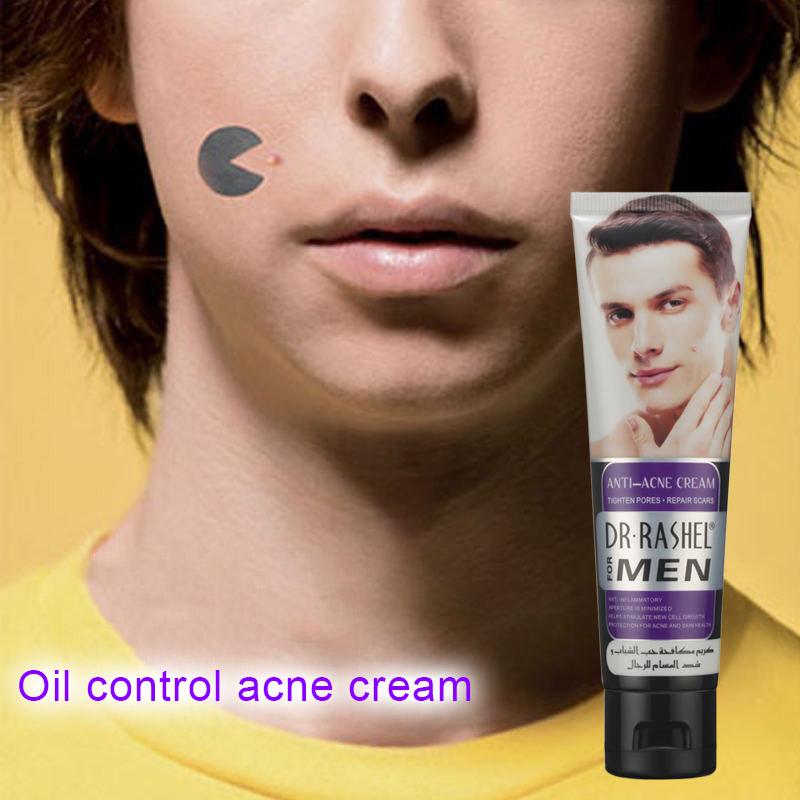 men's skin care acne scars