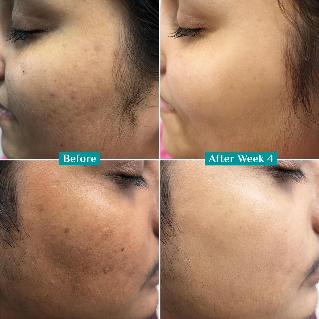 Pilgrim 10% Vitamin C Gesichtsserum 30 ml Für strahlende Haut, Dunkle Fleckenpflege, Ebenmäßiger Teint, Anfängerfreundlich, Alle Hauttypen