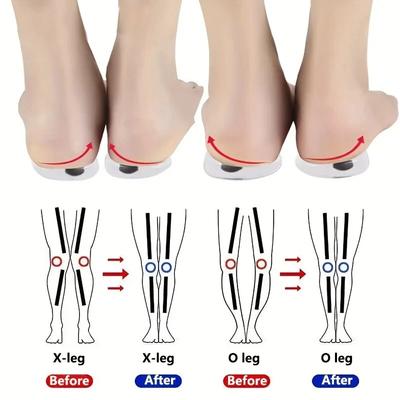 1 Paar orthopädische Einlegesohlen für Füße O/X Beintyp Valguskorrektur Männer Frauen Silikongel Schuheinlegesohle Magnet Massage Schuhpolster