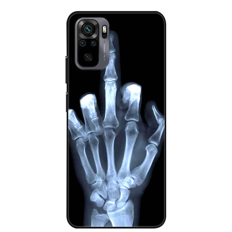 For Xiaomi Redmi Note 10s Case Shockproof Silicone Cartoon Soft Cover for Redmi Note 10 Pro Phone Cases Note10 4G 10T 5G 10 S