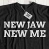 New Jaw Funny Orthognathic Surgery T-Shirt Correction Operation Mouth Operation
