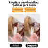 Pet Ear Cleaning Finger Cots Wipes 50Pcs Disposable Dog Cat Ear Care Wipes Gentle Remove Ear Wax Odor Pet Hygiene Supplies
