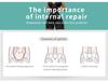 European & American Mesh Abdomen Control Bodysuit - Adjustable Postpartum Shaping Cincher for Women