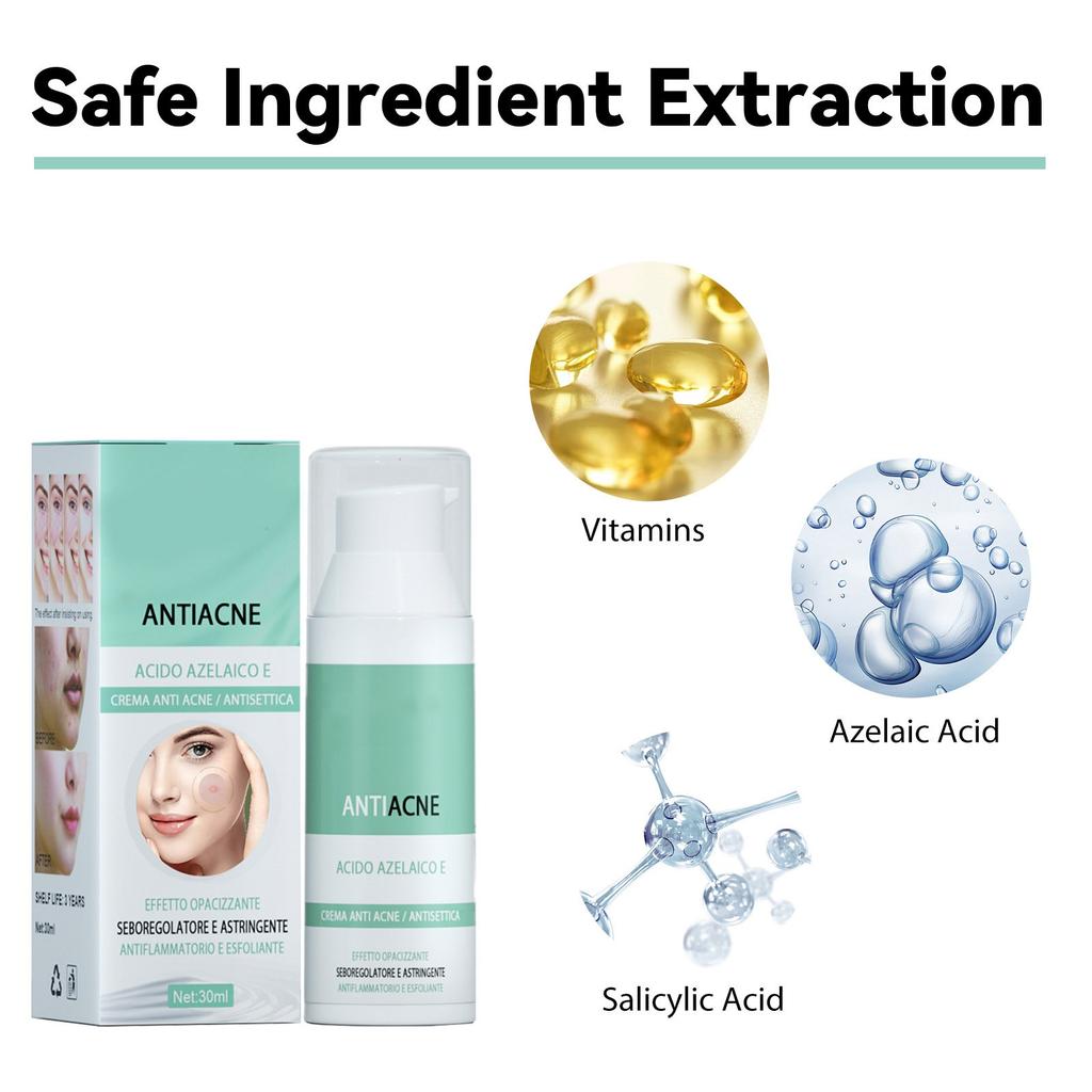 Acne Cream, Facial Cleansing And Acne Cleansing Cream, Gentle Acne Removing And Brightening Facial Skin Care Cream