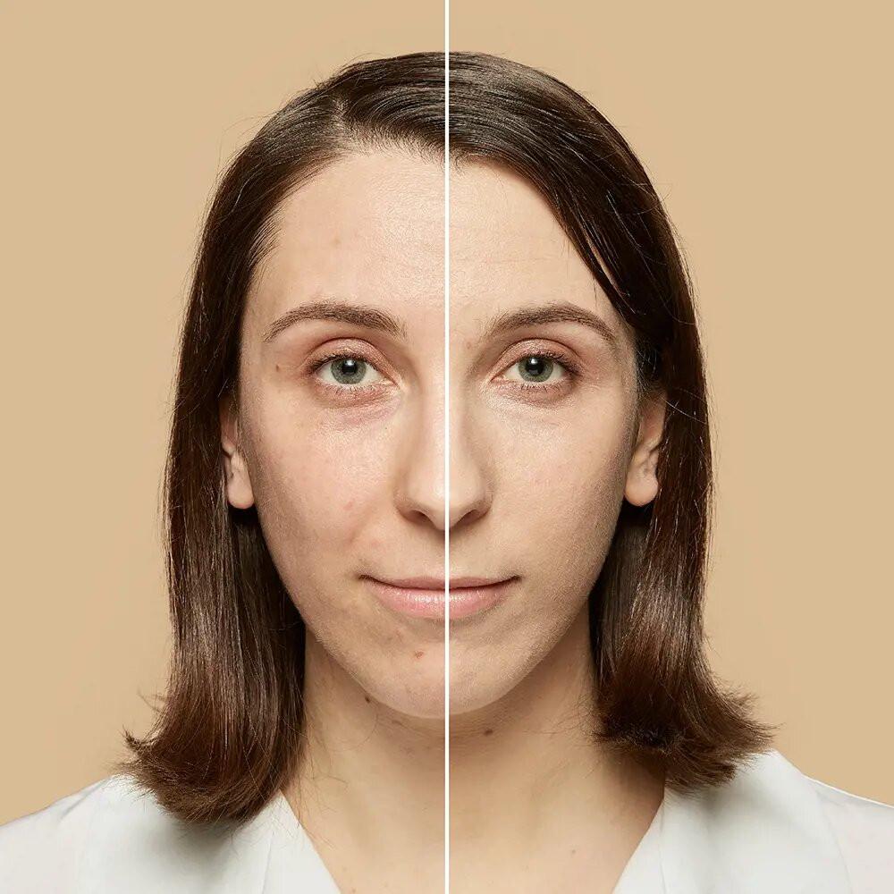 L'Oréal Paris Perfect Accord Hyaluronic Acid Foundation -1.5N Linen - 