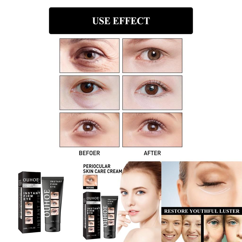 Ouhoe Eye Firming Cream Hydrating Moisturizing Treatment For Dry Fine Lines 30ml